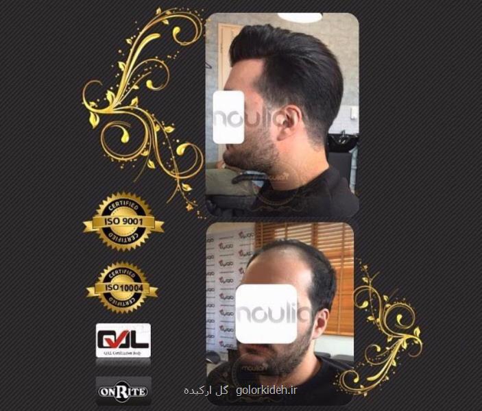 كلینیك ترمیم مو مولیان